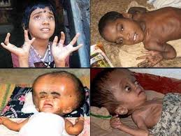 ವಿಷಮುಕ್ತ ಆಹಾರ ಮತ್ತು ಬದುಕು (ಭಾಗ 4)